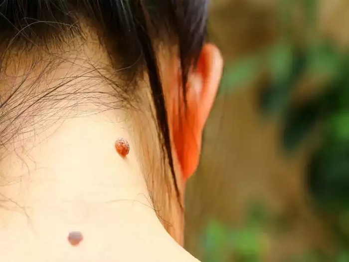 AVS PLASTIC SURGERY AND SKIN CLINIC Pudukkottai